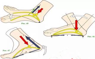 Боль в мышцах ног - причины, характер, лечение